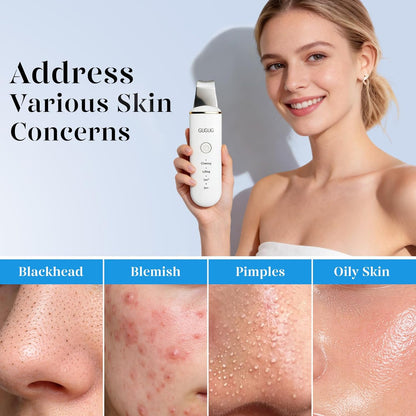 Skin Scrubber Face Spatula Skin Spatula Pore Cleaner Blackhead Remover Tools for Facial Deep Cleansing-4 Modes -White