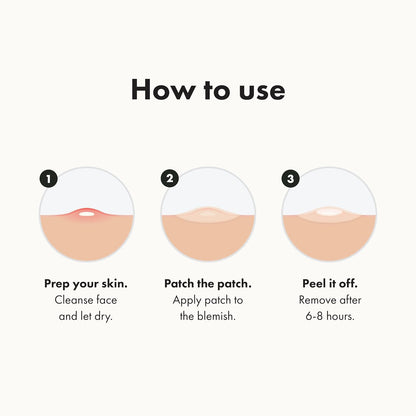 Original Patch from Hero Cosmetics – the #1 Hydrocolloid Acne Pimple Patch for Shrinking Zits and Whiteheads in 1 Use; Nighttime Spot Stickers for Face and Skin (72 Count)