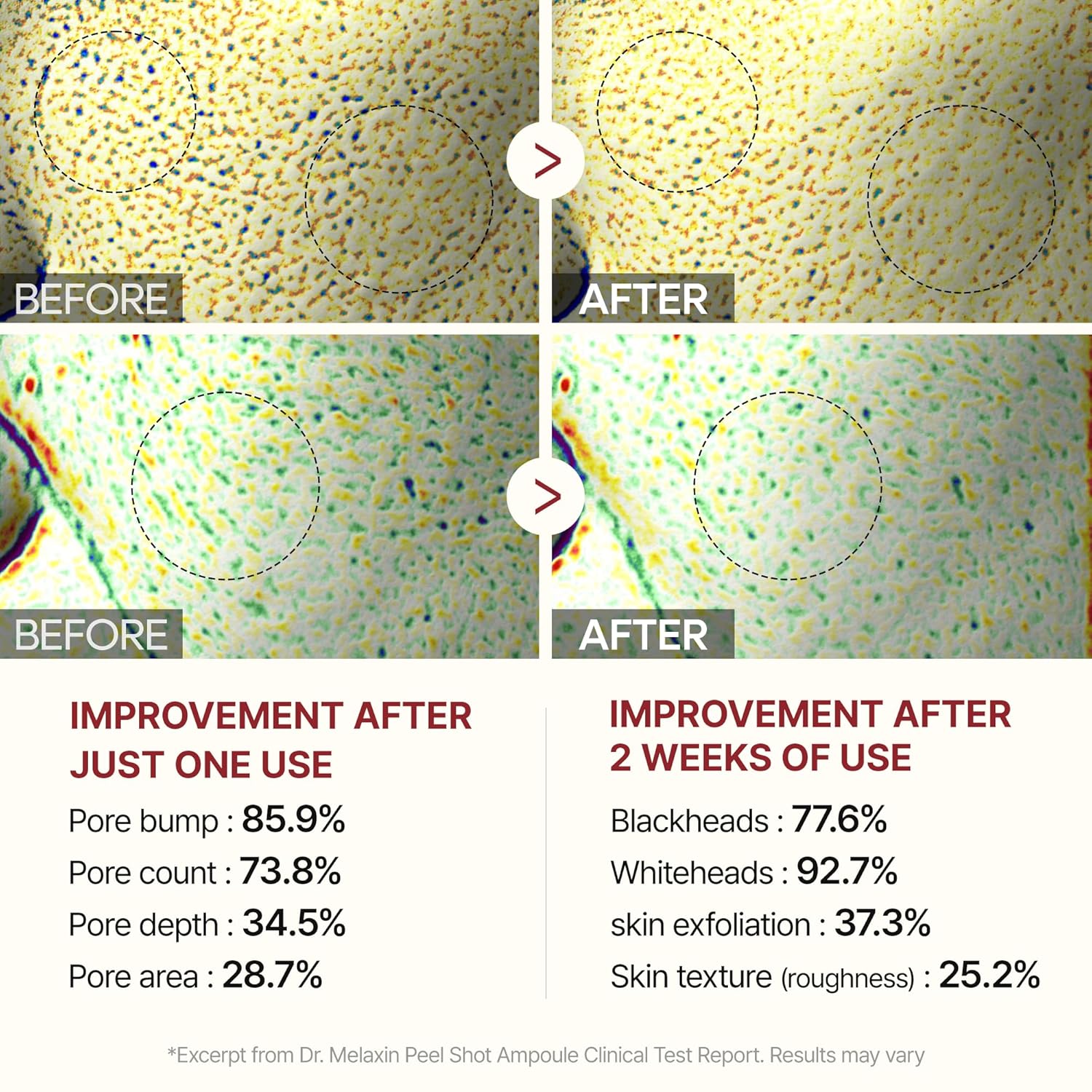 Peel Shot Glow Black Rice Peeling Ampoule 80Ml, Dead Skin Gentle Exfoliating Ampoule with Rice Water Extract, AHA BHA, Niacinamide, Daily Skin Texture Care, All Skin Types, Korean Skincare