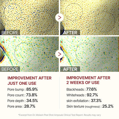 Peel Shot Glow Black Rice Peeling Ampoule 80Ml, Dead Skin Gentle Exfoliating Ampoule with Rice Water Extract, AHA BHA, Niacinamide, Daily Skin Texture Care, All Skin Types, Korean Skincare