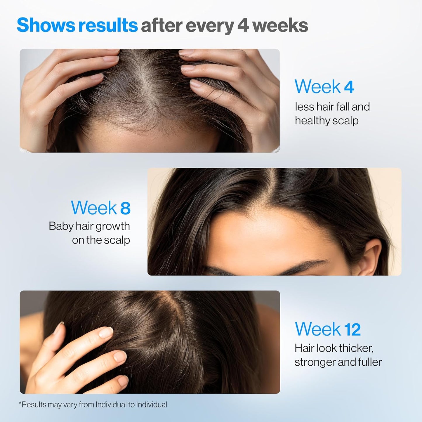 Advanced Hair Density Roll-On Serum 25 Ml | 5% Saw Palmetto, 3% Rosemary, 1% Caffeine Herbasome & 3% Fenugreek | Scalp Serum for Reduced Hair Fall | Men & Women